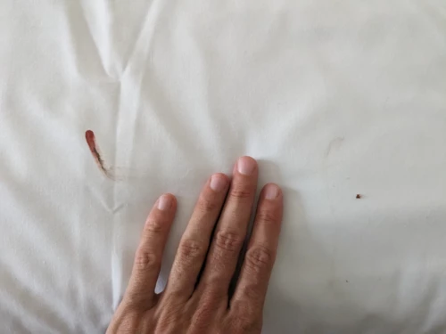 On dort dans un motel pour éviter de mauvaises surprises dans les pubs, mais pas de chance on tombe sur des punaises de lit...et Kristelle se fait dégommer avec presque 30 morsures qui ont duré plus de 2 semaines